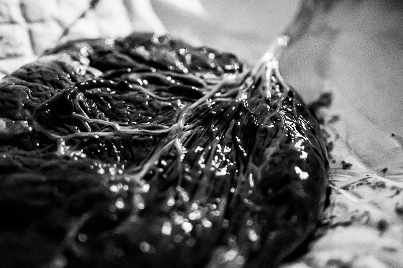 photo du placenta d'un bébé, lors d'un accouchement à la maison. On distingue tous les vaisseaux qui forment comme un arbre dont le tronc est le cordon ombilical. Doula Arles Tarascon